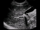 images/thumbs/Fall1SonografieAbdomen.png