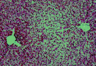 images/thumbs/Fall2HistoLeber.png
