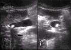 images/thumbs/Fall2Sonografie.png