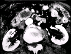 images/thumbs/Fall3Computertomografie.png