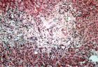 images/thumbs/Fall3HistoLeber.png