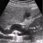 images/thumbs/Fall3Sonografie.png