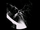 images/thumbs/Fall5ERCP.png