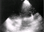 images/thumbs/Fall5SonografieAbdomen.png